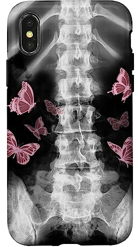 Xray Skeleton Pink Butterfly Egirl y2k Harajuku Dark Grunge Case for iPhone X/XS