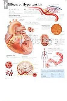 Wandkunst Bild Human Körper Medizinische Bildungskarte Poster menschliche Anatomie Muskelsystem Seidentuch Malerei Wohnheimdekoration(84,80x120cm No Frame)