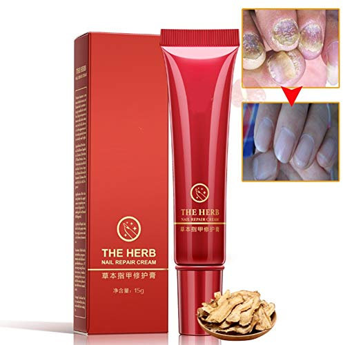 RUIBUY Nail Repair Cream Nail Fungus Treatment Herb Cream Foot Nail Protector Anti Fungal Nail Repair Ointment