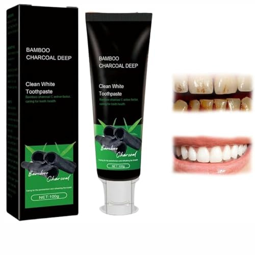 Kicklo Bamboo Charcoal Teeth Whitening Toothpaste,Radiant Whitening Toothpaste,Zahnpasta Radiant Zähne,Tiefenreinigende Zahnpasta,Entfernt Zahnflecken Fresh Breath zahnpasta (1 Stück)