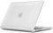 TECOOL Cover per MacBook Pro 14 Pollici M4 M3 M2 M1 Pro Max 2021-2024 (A3401 A3185 A3112 A2992 A2918 A2779 A2442), Custodia Rigida Protettiva Sottile in Plastica, Glitter