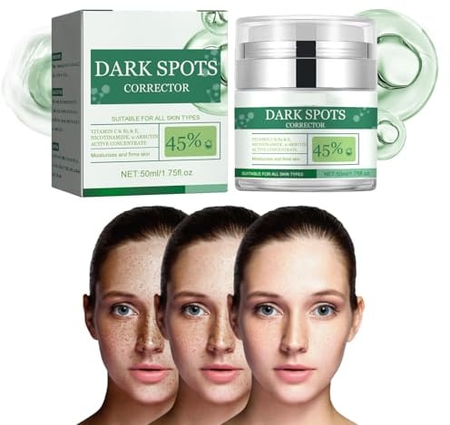 Dark Spot Corrector Cream,Creme Zur Fleckenbehandlung,Creme Zur Korrektur Dunkler Flecken,Haut Aufhellende Creme Gesicht Creme Gegen Altersflecken/Dunkle Flecken Sommersprossen Entferner,50ML