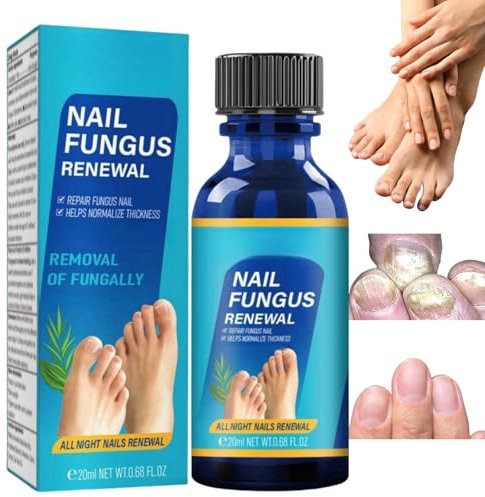 AINxtolm Toenail Fungus Treatment, Nail Repair & Growth Serum, Navy, Nail Treatment, Versatile Nail Treatment