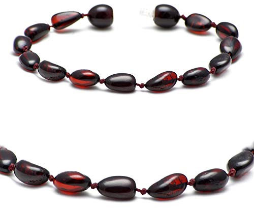 Echtes Bernstein Armband - Ostsee Schmuck - Roh Anti Stress Armband aus Ostsee Echt Stein Perlen - Echter Bernstein Schmuck, beliebt als Glücksstein (KIRSCHE, 20 CM)