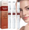 Stylo Anti Verrue, Stylo Pour Enlever Grain De Beauté, Stylo Anti Acrochordons, Essuyez Les Étiquettes Et Les Taupes