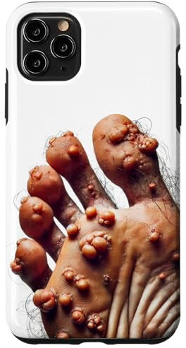 iPhone 11 Pro Max Funny Ugly Cringe Phone Case