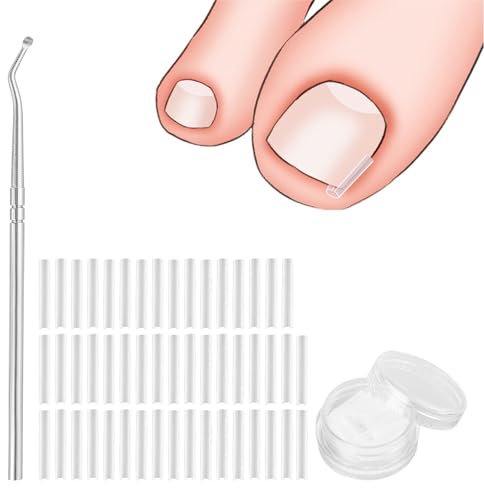 zoerbufan Set di Unghie Incarneato 51 pz, Unghia Incarnita Alluce Utensili per Unghie Incarnite Strumento per Unghie, Sollevatore Per Unghie Incarnite