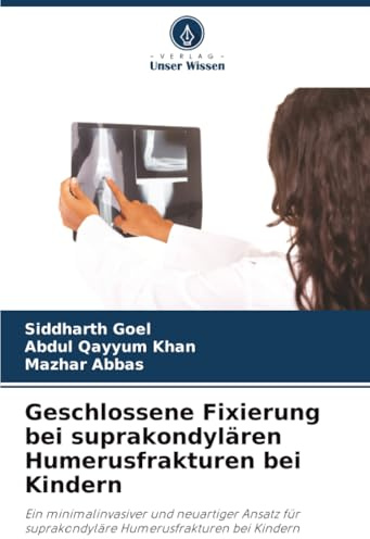 Geschlossene Fixierung bei suprakondylären Humerusfrakturen bei Kindern: Ein minimalinvasiver und neuartiger Ansatz für suprakondyläre Humerusfrakturen bei Kindern