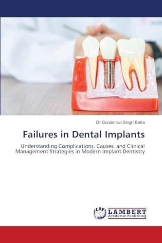 Failures in Dental Implants: Understanding Complications, Causes, and Clinical Management Strategies in Modern Implant Dentistry