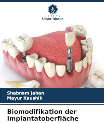Biomodifikation der Implantatoberfläche