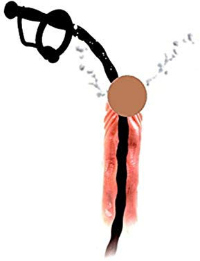 OnundOn Katheter Harnröhre Mann Dilator Harnröhre Silikon Prinzenzepter Hohl Urethral Dilator Plug Masturbation Flexiblem Lange 350mm, ca.Ø 6mm (Schwarz)