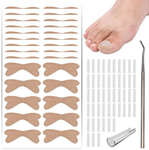 Juego de correctores de uñas encarnadas – 50 tiras alisadoras de uñas sin dolor con levantador de uñas de los pies +10 calcomanías para uñas encarnadas