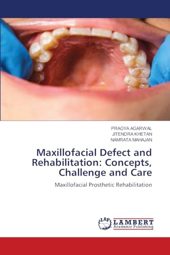 Maxillofacial Defect and Rehabilitation: Concepts, Challenge and Care: Maxillofacial Prosthetic Rehabilitation