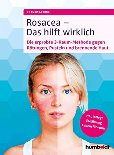 Rosacea – Das hilft wirklich: Die erprobte 3-Raum-Methode gegen Rötungen, Pusteln und brennende Haut, Hautpflege, Ernährung, Lebensführung