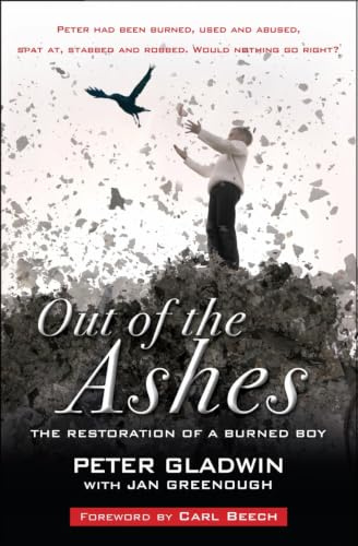 Out of the Ashes: The Restoration of a Burned Boy