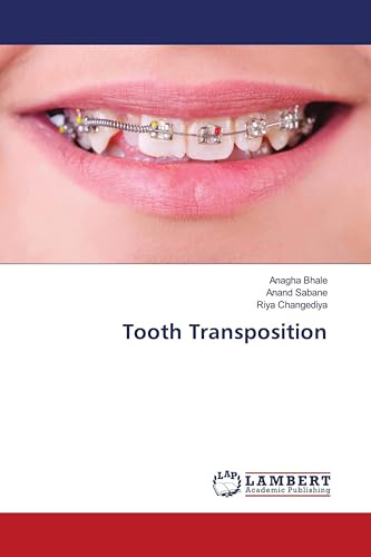 Tooth Transposition: DE