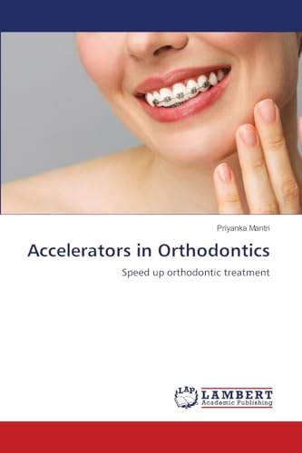 Accelerators in Orthodontics: Speed up orthodontic treatment