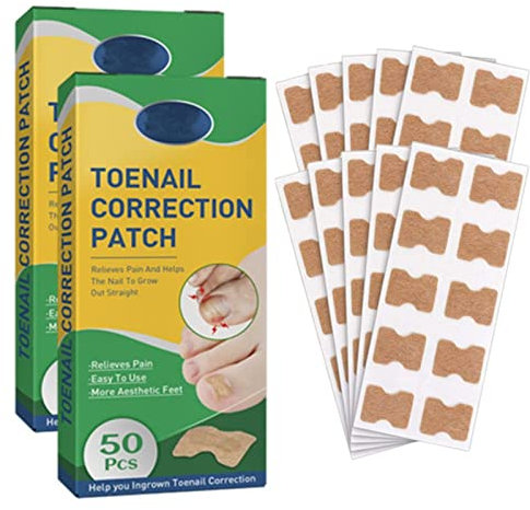Fitmedify Nagelpflaster – Korrekturflicken für schöne und gesunde Nägel, Zehennagelkorrektur-Patch, eingewachsene Zehennagel-Korrektur, passend (100 Stück)