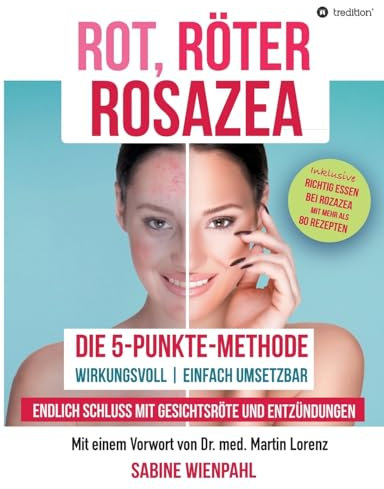 ROT RÖTER ROSAZEA: Die 5-Punkte-Methode – Endlich Schluss mit Gesichtsröte und Entzündungen