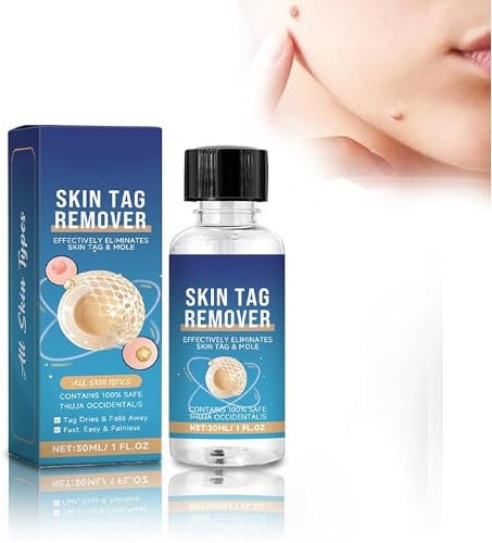 Azote Liquide Verrue Remover, pour enlever les verrues sur les mains et le corps, rapide pour enlever les verrues, adapté à toutes sortes de peaux (30ml)