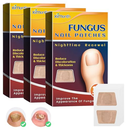 96 Stück Nagelpflaster Nagelpilz Pflaster Nagel Reparatur Pflaster Zehennagel-Nagelreparaturpflaster Repariert das Erscheinungsbild Beschädigter und Verfärbter Nägel