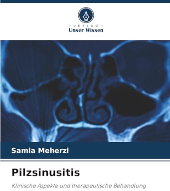 Pilzsinusitis: Klinische Aspekte und therapeutische Behandlung