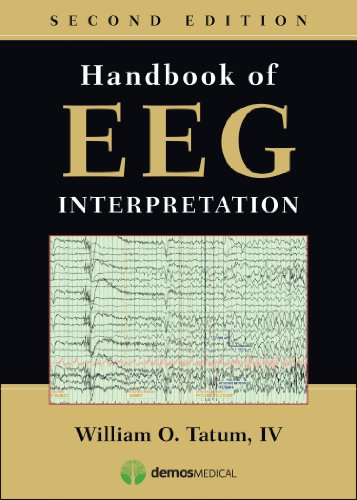 Handbook of EEG Interpretation, Second Edition (English Edition)