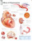 Effects of Hypertension Paper Poster