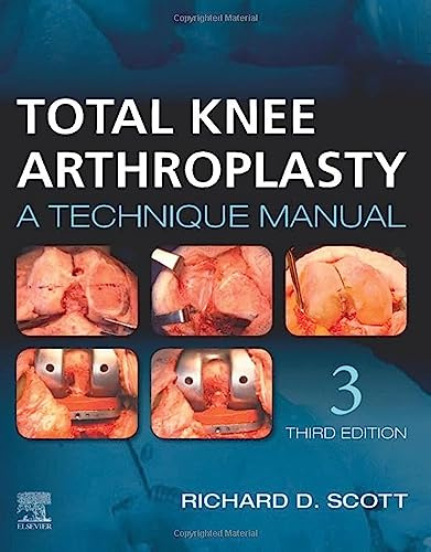 Total Knee Arthroplasty: A Technique Manual