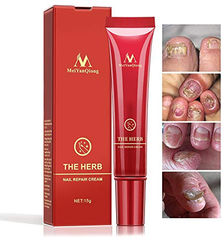 Herbal Foot Nail Cream, Protector Skin Care Cream Ointment Treatment Toe Nail Onychomycosis Paronychia Anti Fungal Treatment Nail Repair Cream, 15g