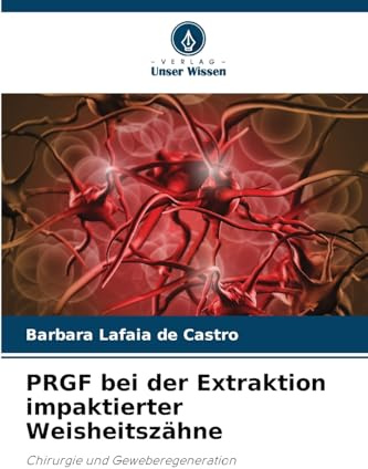 PRGF bei der Extraktion impaktierter Weisheitszähne: Chirurgie und Geweberegeneration