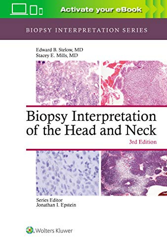 Biopsy Interpretation of the Head and Neck (Biopsy Interpretation Series)