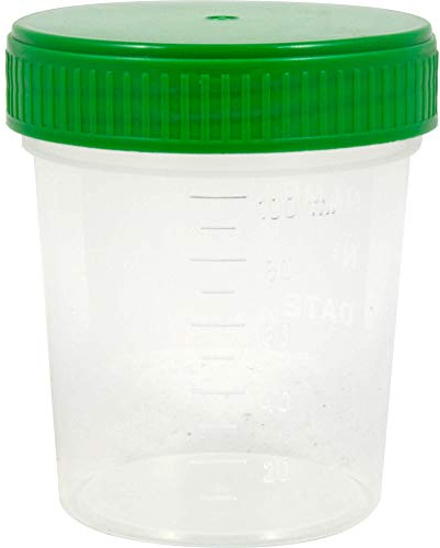 DR. JUNGHANS Urinbecher mit Schraubdeckel, 1 St. Becher