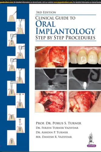 Clinical Guide to Oral Implantology: Step by Step Procedures