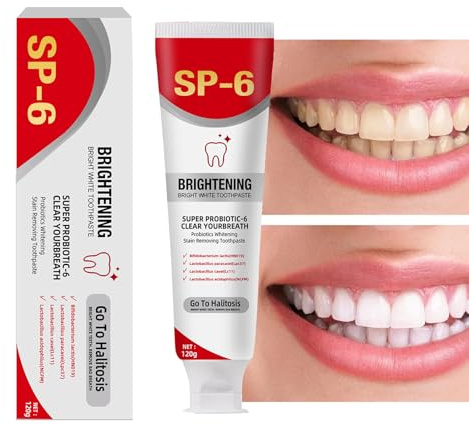Whitening Toothpaste - 120g Teeth Whitening Toothpaste | Intensive Whiteninng Toothpastte | Radiance Whiteninrg Zahnpasta | Pflegeformel zur Fleckenentfernung, strahlendes Lächeln, Hygiene