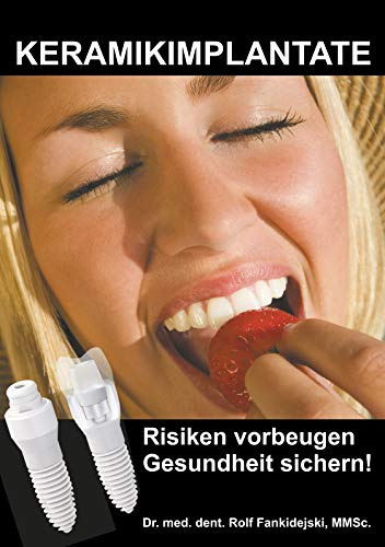 Keramikimplantate: Risiken vorbeugen, Gesundheit sichern!