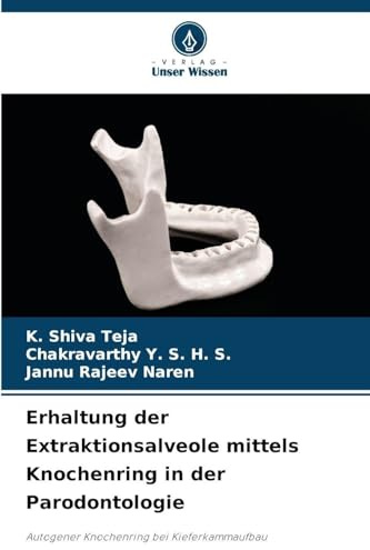 Erhaltung der Extraktionsalveole mittels Knochenring in der Parodontologie: Autogener Knochenring bei Kieferkammaufbau