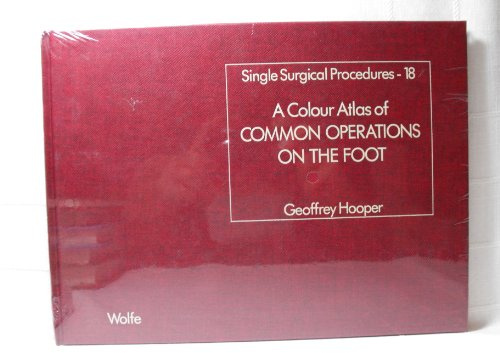 Common Operations of the Foot (Colour Atlas on Single Surgical Procedures S., Band 18)