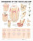 Disorders of the Teeth and Jaw Anatomical Chart