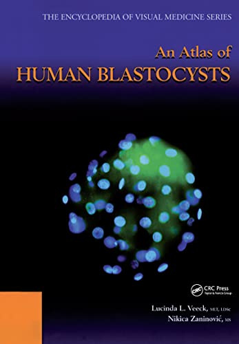An Atlas of Human Blastocysts (Encyclopedia of Visual Medicine Series, 59, Band 59)
