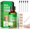 Extra Strong Fungal Nail Treatment, Nail Fungus Treatment for Toenail with Tea Tree Oil, Toe Nail & Ingrown Toenail Treatment, Nail Growth Treatment, Improves Thick Discolored Nails, 30ml + 5 Patches