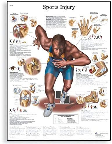 3B Scientific VR1188UU Anatomie des Menschen – Schaubild der Sportverletzungen, gedruckte Version