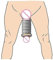 XKCGH Penisvergrößerung, Profi Penis Extender Vergrößerer Enhancer System Tragbar, Cock Enlargement Bahre Kit Verbesserung, Potenzmittel Vakuum pumpe, Sexspielzeug für Männer