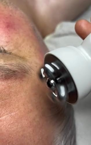 Massaggiatore lifting viso con Radio Frequence