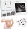 Tissting Sonogram Bilderrahmen 22 x 12 cm Massivholz Ultraschall Fotorahmen mit Countdown Kalender, Vertikal und Hängende Baby First Scan Ultraschallbilder Rahmen für 7,5 x 10 cm Fotos