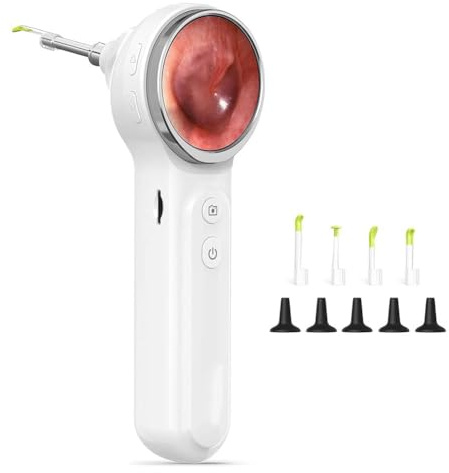 Ujjdwiurgh Otoscope with Light Digital Otoscope W/1.85in IPS Screen for Kids and Adults, Ear Scope
