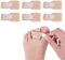6Pcs Hammer Toe Straightener, Hammer Toe Splints, Toe Cushioned Bandages for Correcting Hammer Toes, Crooked Toes & Overlapping Toes，Protecting Curved Toes and Hammertoes, Overlapping Toe Protector