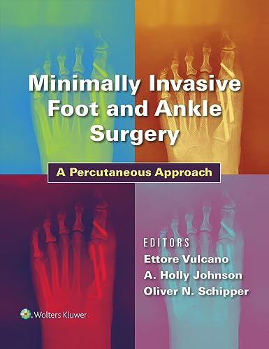 Minimally Invasive Foot and Ankle Surgery: A Percutaneous Approach