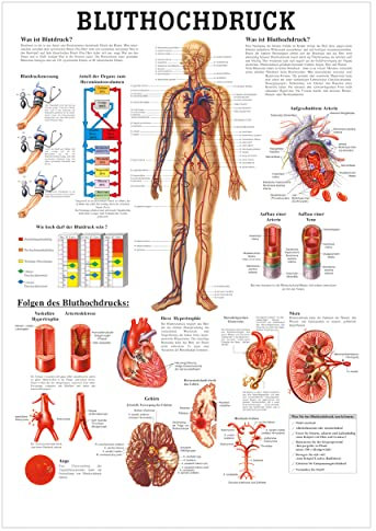 Rüdiger Bluthochdruck Poster Anatomie 70x50 cm medizinische Lehrmittel