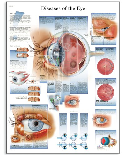 3B Scientific VR1231UU Menschliche Anatomie, Krankheiten des Auges, Papierversion, unlaminiert